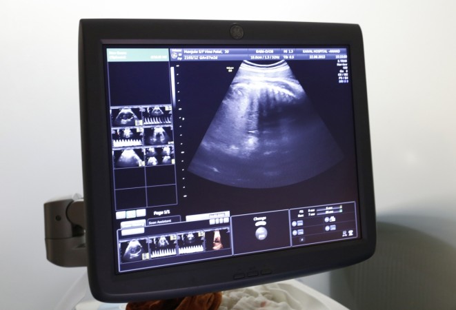 IVF CEntre