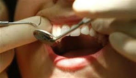 Increases In Tooth Erosion Due To Soda, Fruit Juice And Other Acid Containing Drinks