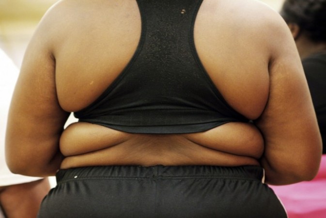 Picture for representation Obesity
