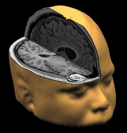 brain