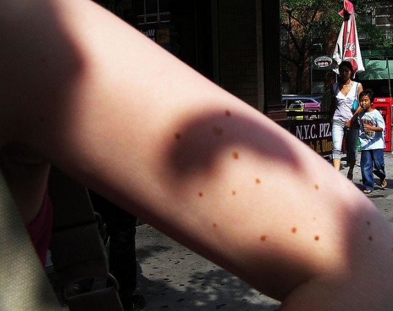 moles