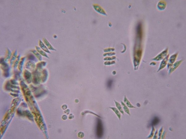 ATCV-1 virus that infects green algae (shown under a microscope) are also capable of making humans more stupid ATCV-1 virus that infects green algae (shown under a microscope)are also capable of making humans more stupid