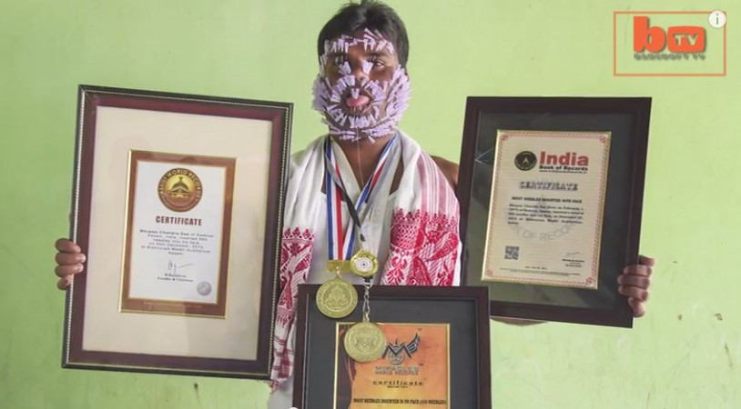 India's Needleman