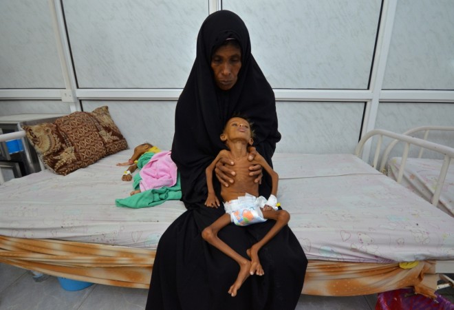 Malnutrition