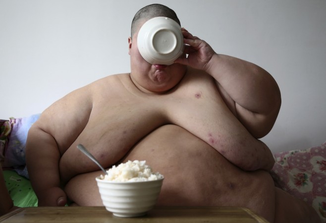 Representational image World's most obese man