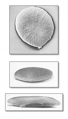 Scanning electron micrograph of a single Neisseria gonorrhoeae bacterium, which causes the STD gonorrhea Gonorrhea