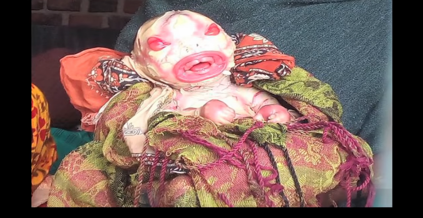 A mother gave birth to this premature 'alien' baby girl in Bihar, India and she refuses breastfeeding her. alien, baby, girl, Bihar, mother, India, scary, breastfeeding, premature,