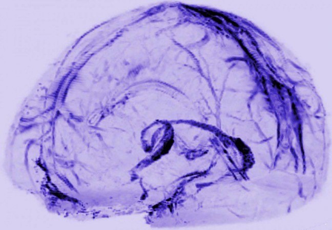 brain, lymphatic vessels,
