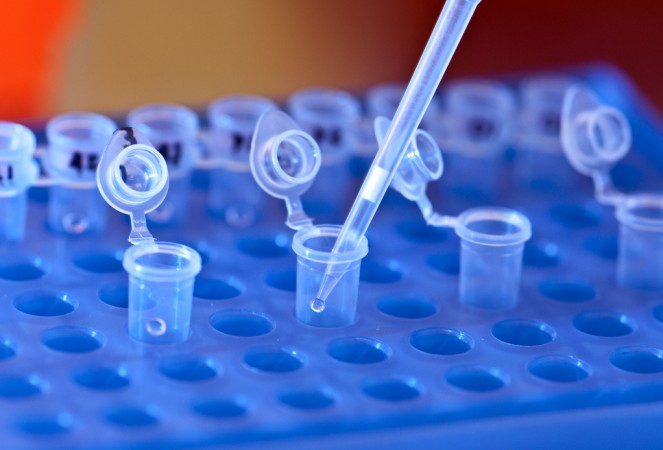 DNA sample (Representational image) DNA sample