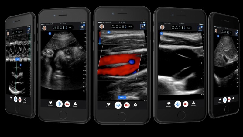 Image generated by ultrasound machine seen on iPhone screen Image generated by ultrasound machine seen on iPhone screen