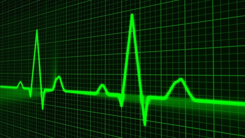 Representational Image heartbeat