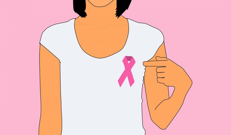 Breast Cancer Breast Cancer