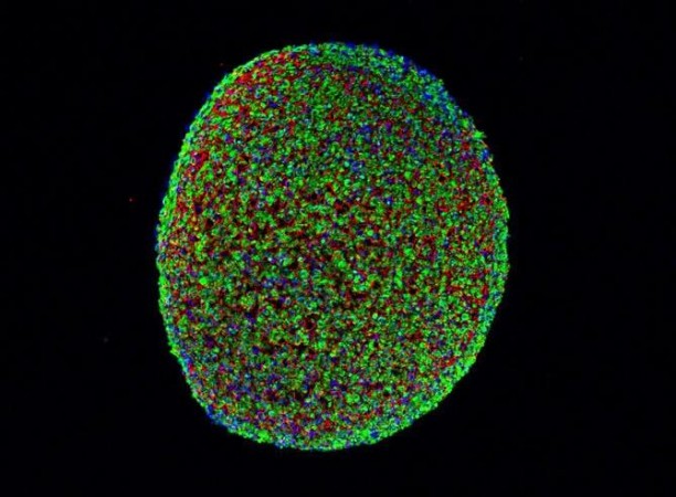 A cross section of a muscle fiber grown from induced pluripotent stem cells. The green indicates muscle cells, the blue is cell nuclei, and the red is the surrounding support matrix for the cells. pluripotent stem cells