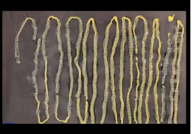 Shocking! Giant 9-foot Tapeworm Found In Sushi-lover's Stomach ...