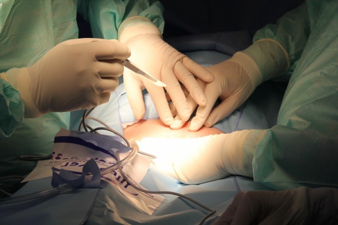 Representational image. surgery