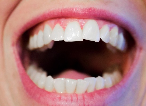 Representational Image. mouth
