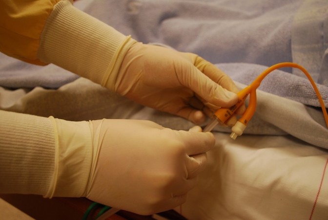 Woman hasn't urinated naturally in two years due to a rare condition known as Fowler's syndrome catheter