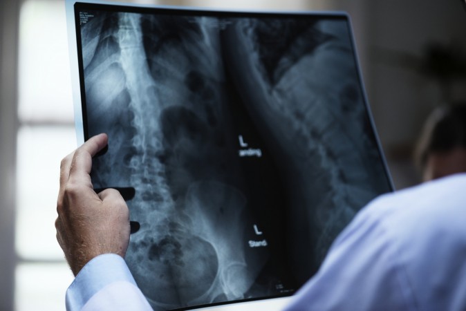 CT scan and chest X-rays will assist doctors in diagnosing cancer and lief threatening diseases scan