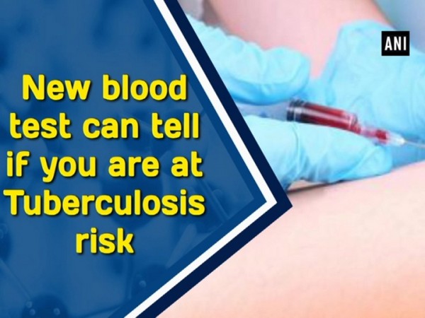 The standard, ID, route of BCG administration may not generate enough of these critical cells in the lungs. TB Blood test