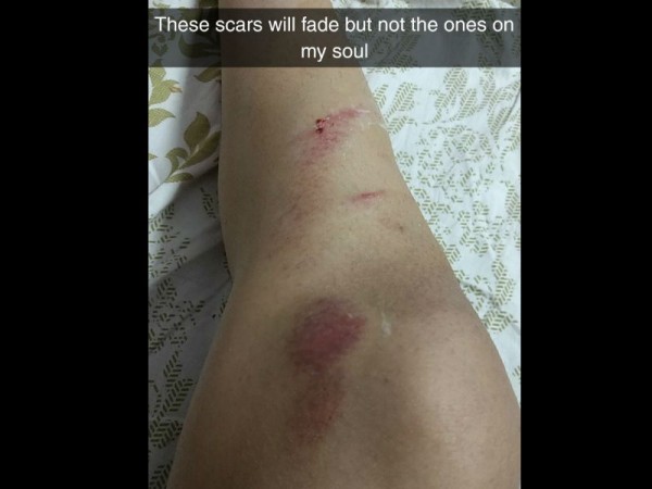 MP model harassed, molesters try to pull skirt to 'see what's underneath'