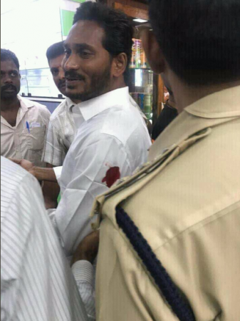 Reddy was attacked at the Vizag airport when he was on his way to Hyderabad jagan mohan reddy