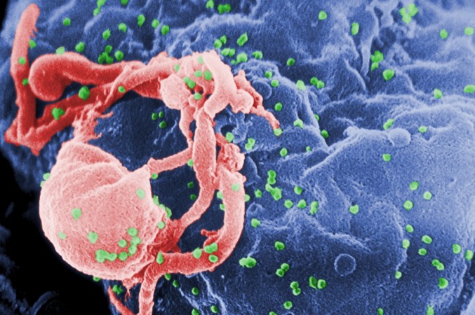 Scanning electron micrograph of HIV-1, colored green, budding from a cultured lymphocyte. Human Immuno Virus