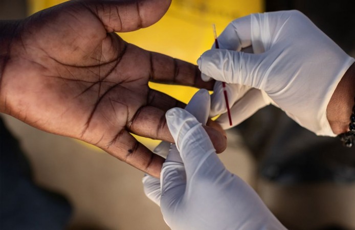 A finger prick is used for a rapid HIV test, which provides results in 15 minutes Apple, RED, Global Fund, AIDS, HIV, Worlds AIDS Day, 2018
