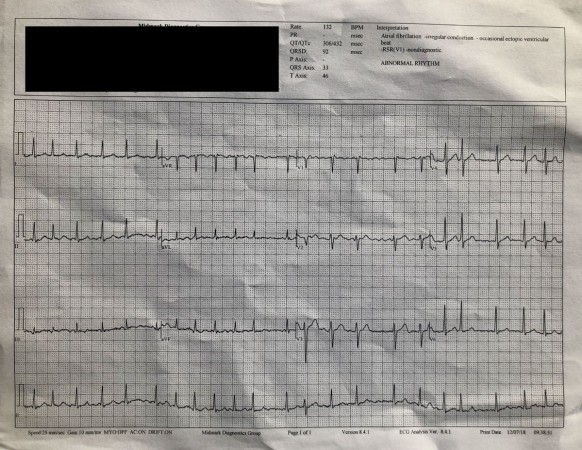 heart watch test apple 4 AFib 4 ECG Watch Apple owner, app in detects Series saves