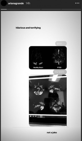 Ariana Grande shares a picture of her brain scan on her Instagram Story Ariana Grande