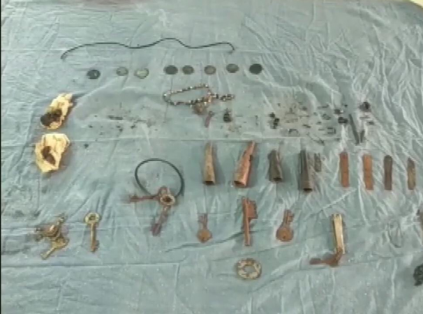 Around 80 objects were recovered from the stomach of a patient in Udaipur. 80 objects