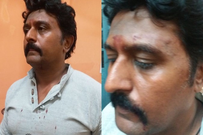 Komal Kumar was trashed by a biker in a road rage. Jaggesh's brother Komal Assaulted