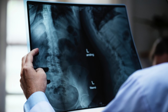 The full-night polysomnography recorded brain waves, oxygen level in participants' blood, as well as their heart rate and breathing. spinal cord