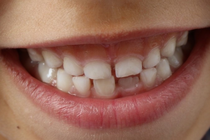 Teeth Teeth