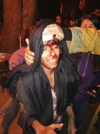 JNUSU President Aishe Ghosh after being attacked on Sunday. Aishe Ghosh