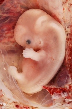 New Technology Can Help Prospective Parents Meet Their Baby Even before it's Conceived (Wiki Commons/Ed Uthman)