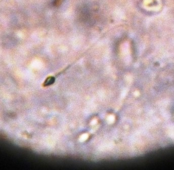 Scientists Create Artificial Human Eggs and Sperms