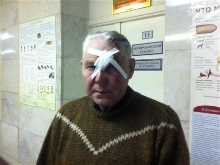 A man identifying himself as Viktor poses for a photograph after receiving treatment for injuries sustained from a shock wave that followed after a falling object was sighted in the sky in the Urals region, at an emergency room in a hospital in Chelyabinsk February 15, 2013. A man identifying himself as Viktor poses for a photograph after receiving treatment for injuries sustained from a shock wave that followed after a falling object was sighted in the sky in the Urals region, at an emergency room in a hospital in Chelyabins