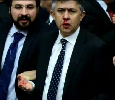 A Turkish MP with a bloody nose/videograb A Turkish MP with a bloody nose/videograb