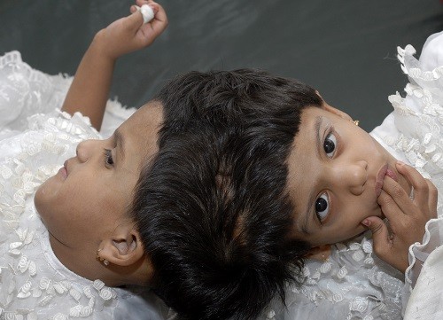 Vani (L) and Veena