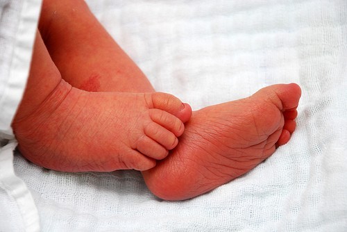 The new-born, has already become the centre of attraction in Baruipur village in West Bengal. Baby toes