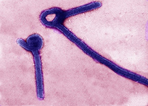A transmission electron micrograph shows Ebola virus particles in this undated handout image released by the U.S. Army Medical Research Institute of Infectious Diseases (USAMRIID) in Fredrick, Maryland. ebola
