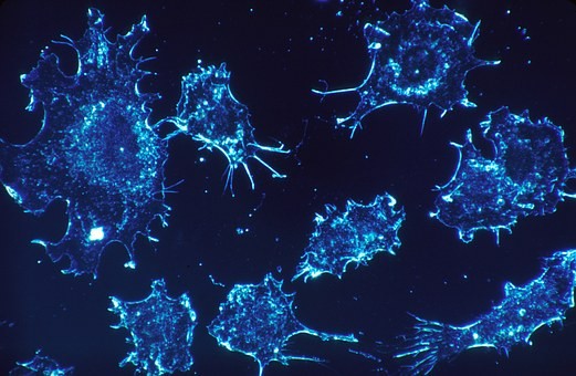 Representational Image cancer cells