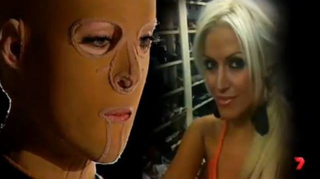 Dana Vulin from Perth suffered third-degree burns covering 64% of her body by a woman who was jealous with Vulin's looks Australian Woman Survives Third-degree Burns, Unmasks Her New Face