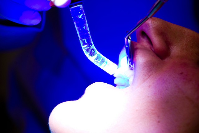 dentist, teeth