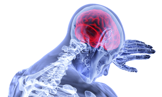 Picture for representation brain