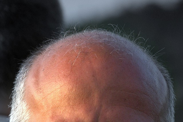bald
