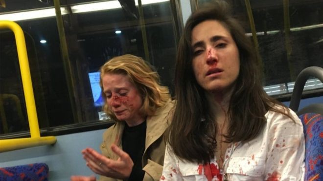Gay couple that was attacked while onboard a night bus in London on May 30 London gay couple
