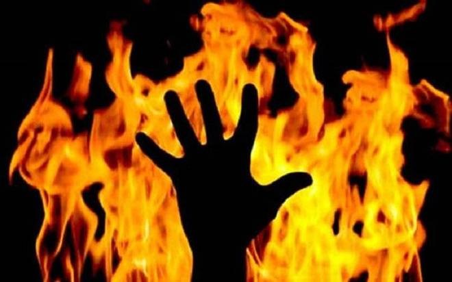 She is survived by three children and a husband who works abroad. (Representational Image) Burn