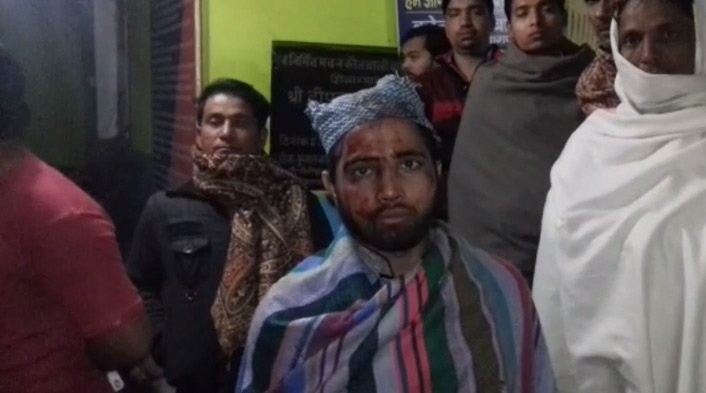 One of the Muslim clerics who was thrashed by a group of six to seven people inside the train. They reportedly tried to push him off the moving train. Muslim man thrashed