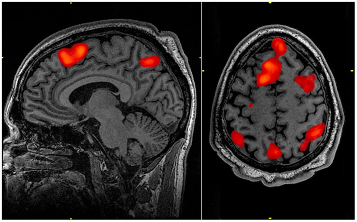 An fMRI brain scan during working memory tasks for representation only Brain scan can tell how dumb you are